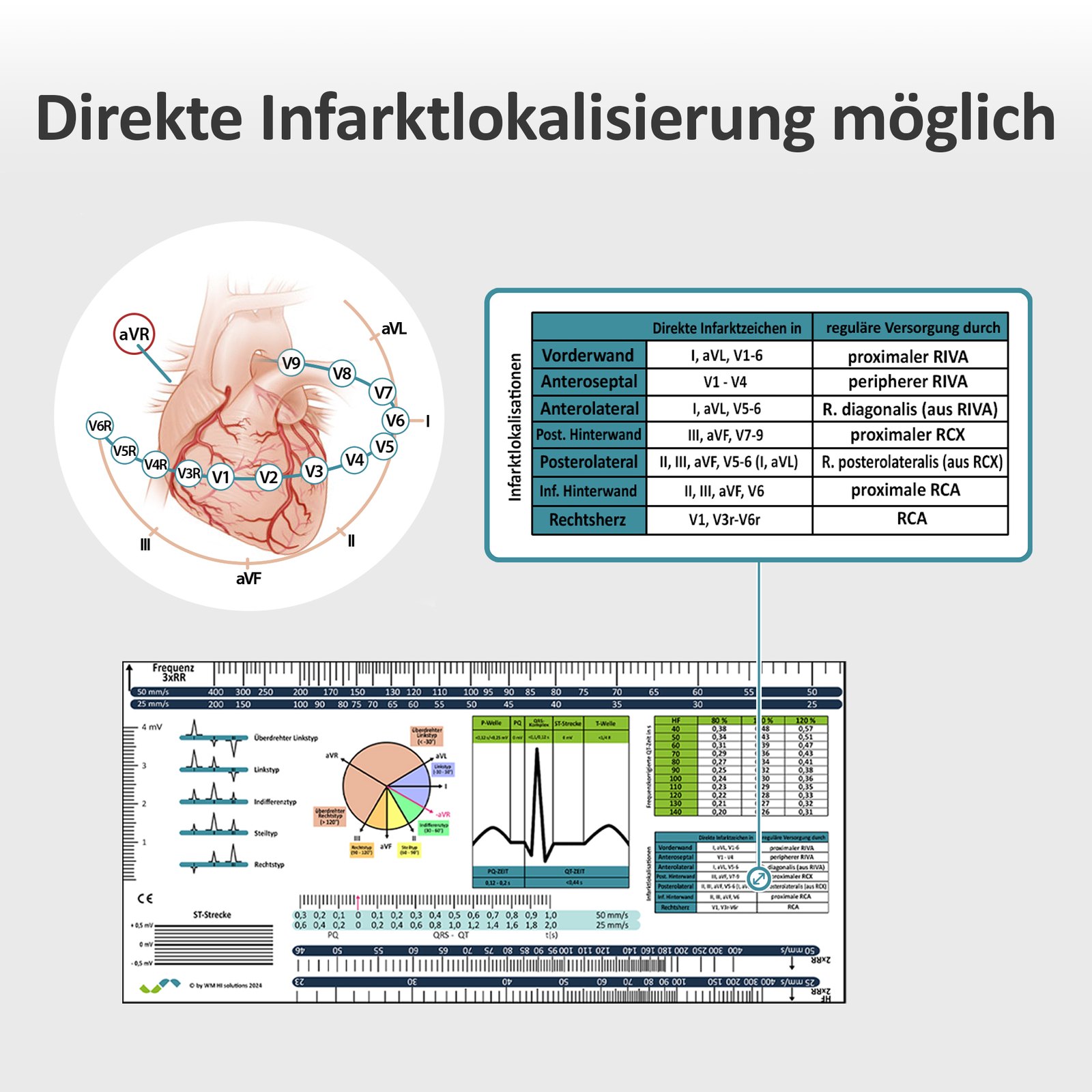 EKG-Lineal V1 – Werbebild