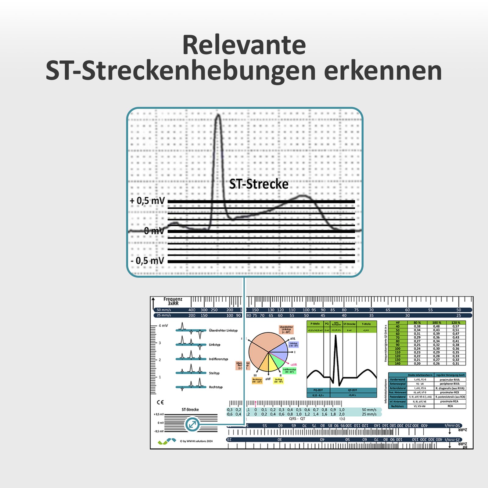 EKG-Lineal V1 – Werbebild