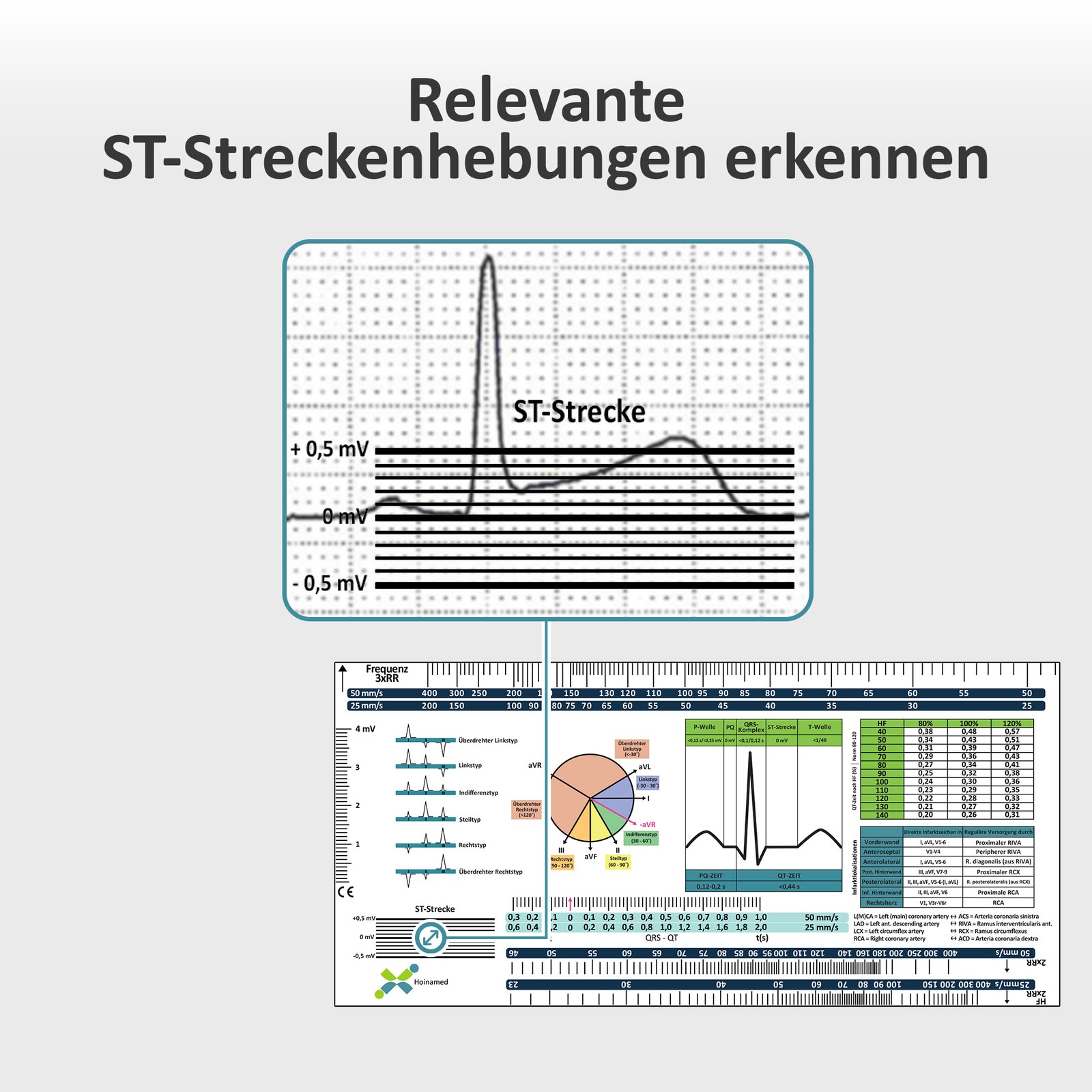 EKG-Lineal V2 – Werbebild