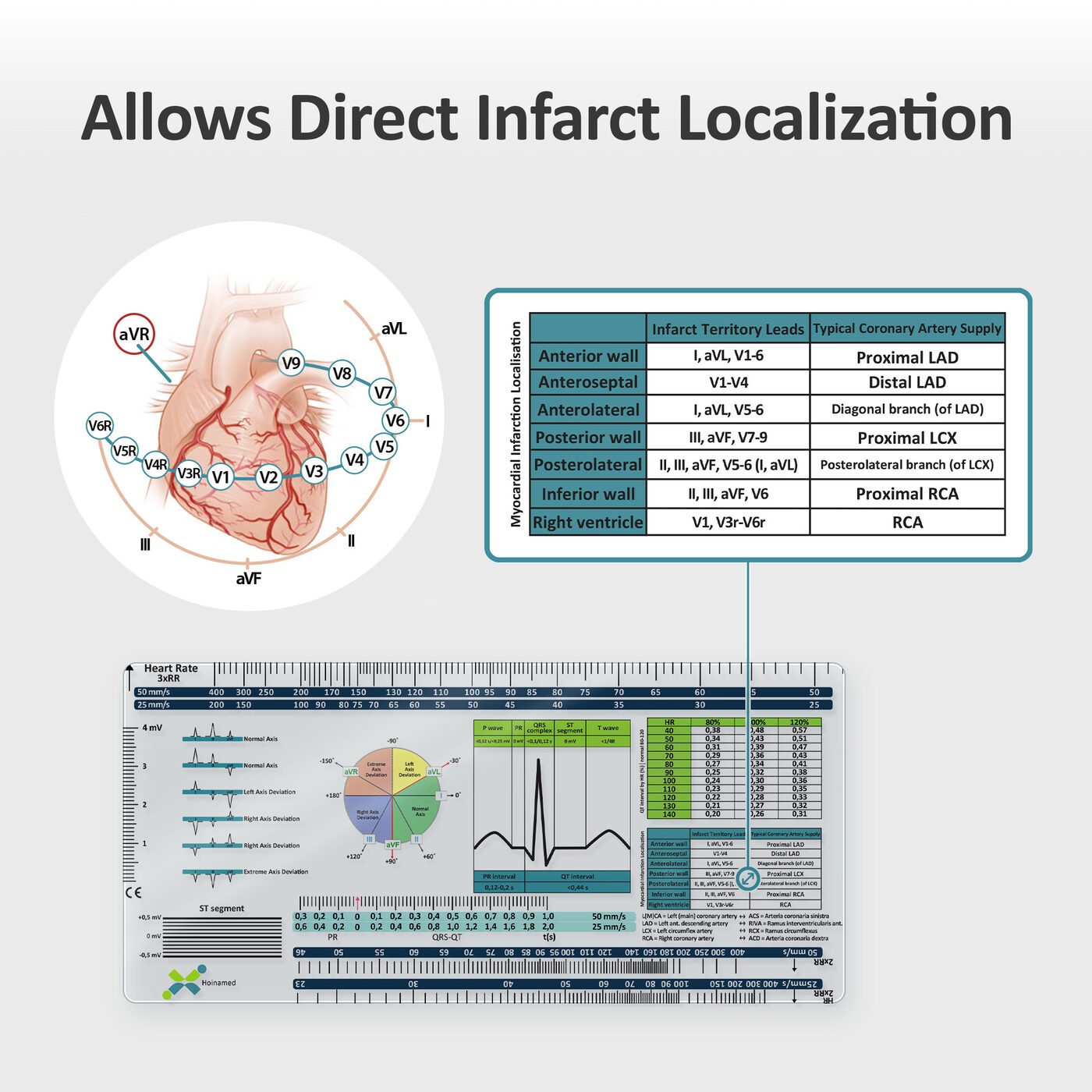 ECG Ruler: Direct infarct localization