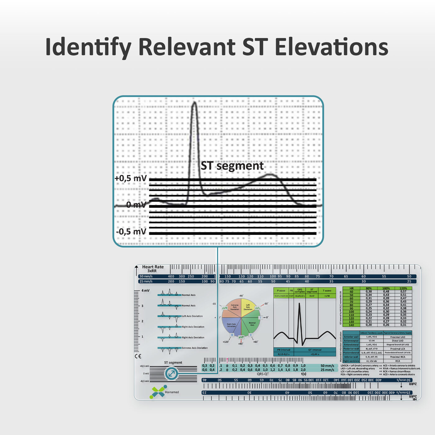 Identify relevant ST elevations