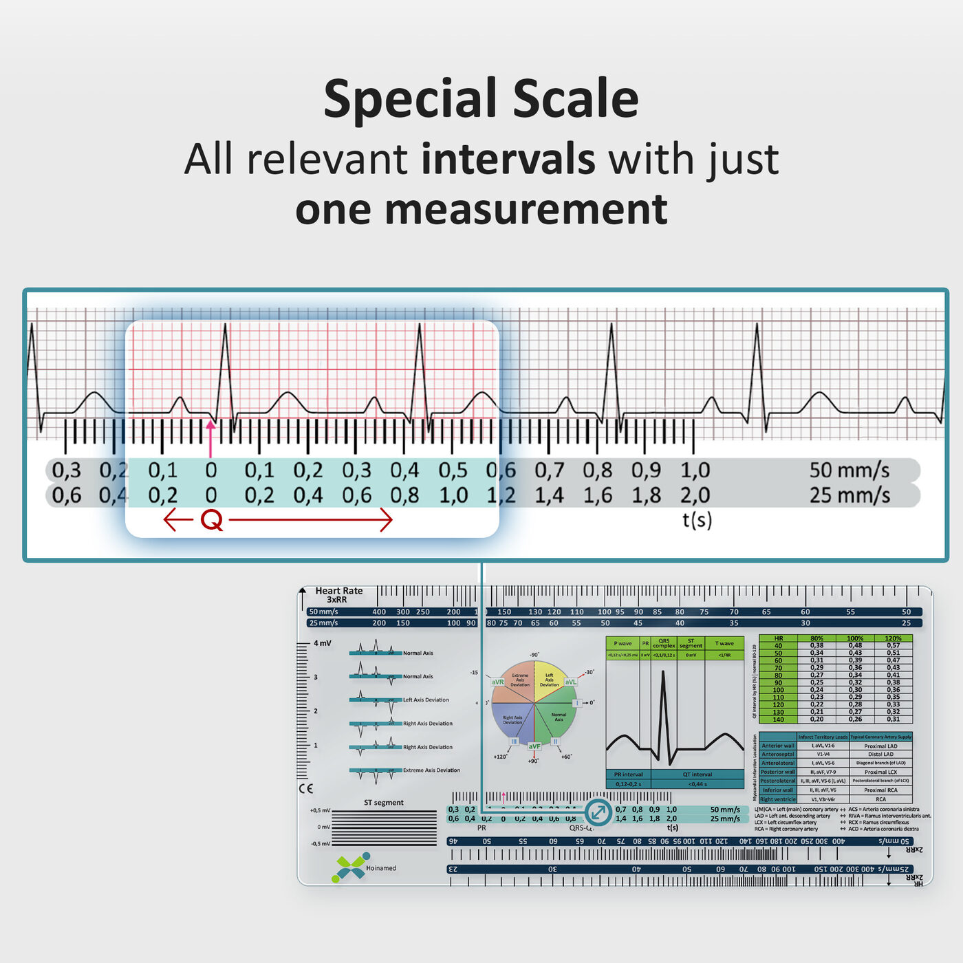 ECG Ruler: Special scale: all intervals with one measurement