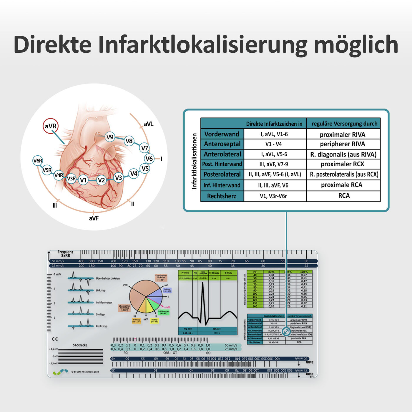 Direkte Infarktlokalisierung