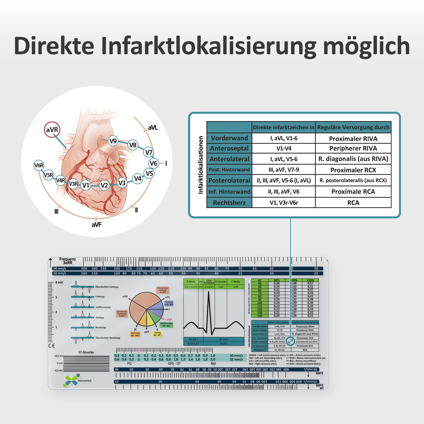 Direkte Infarktlokalisierung