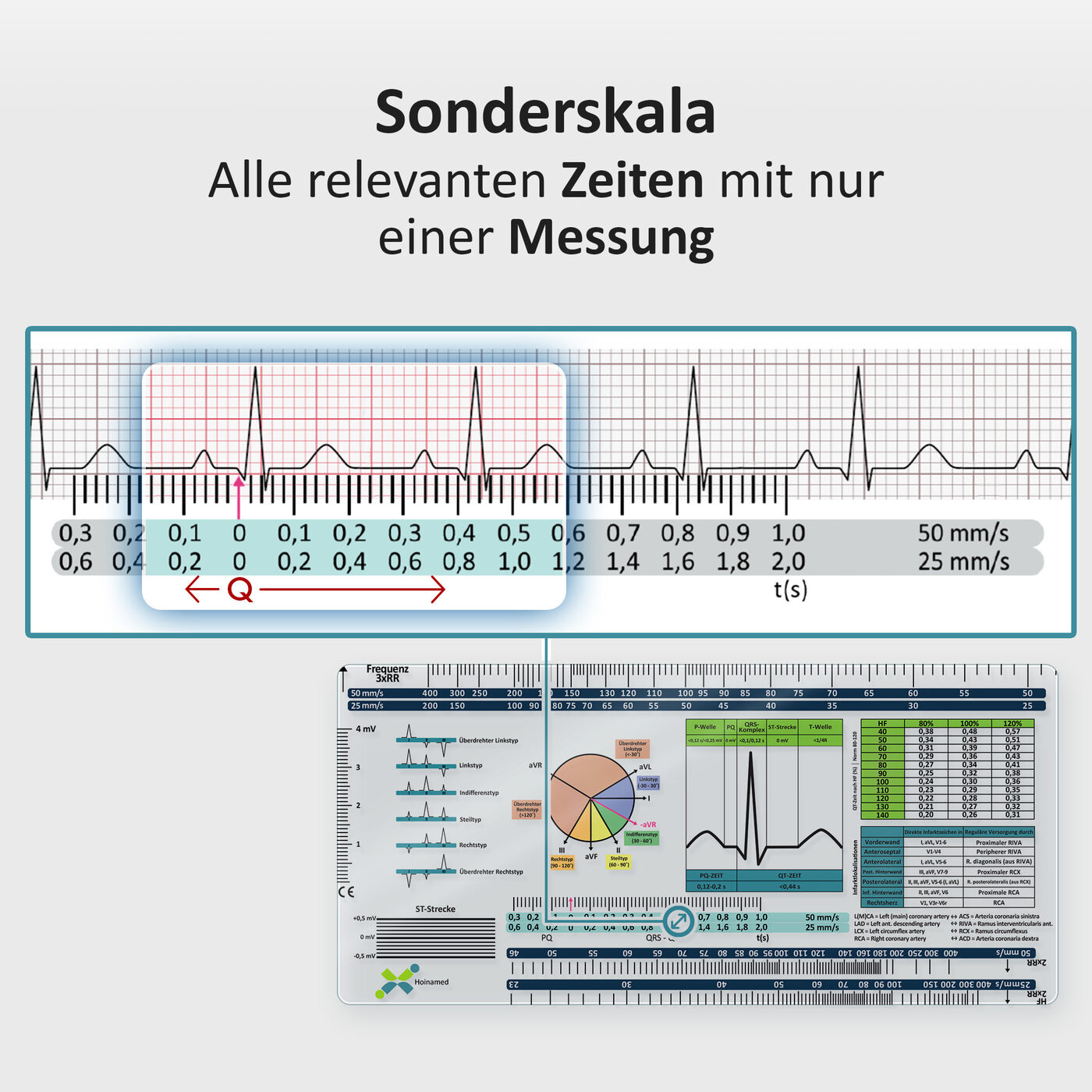 EKG-Lineal V2: Sonderskala: alle Zeiten mit nur einer Messung