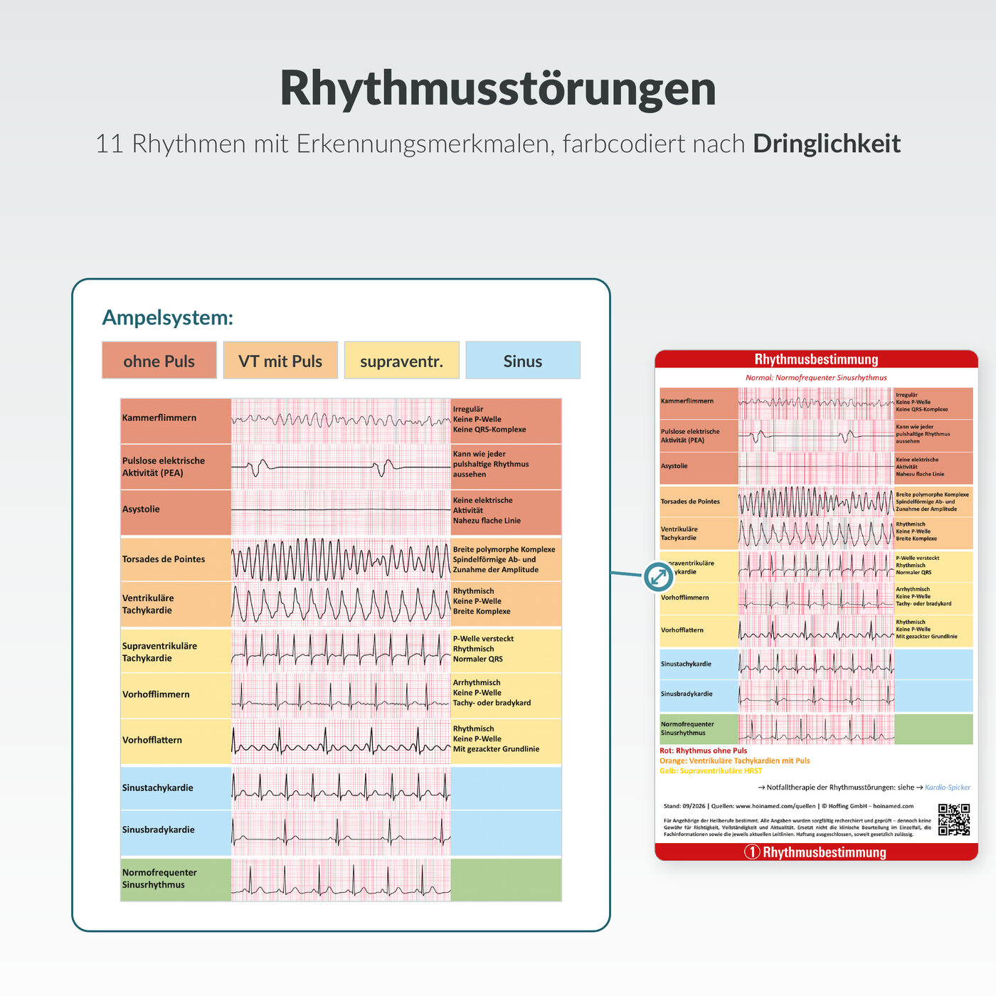 EKG-Spicker: Rhythmusstörungen auf einen Blick
