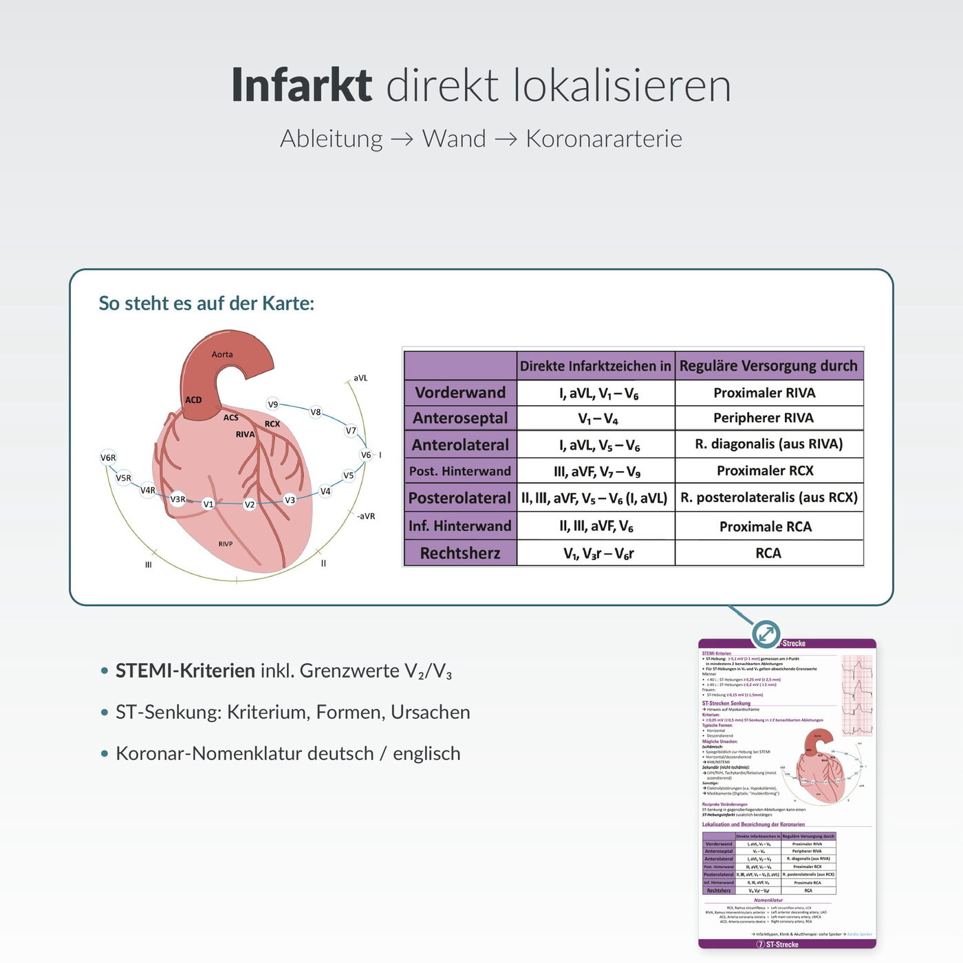 EKG-Spicker: Infarkt direkt lokalisieren