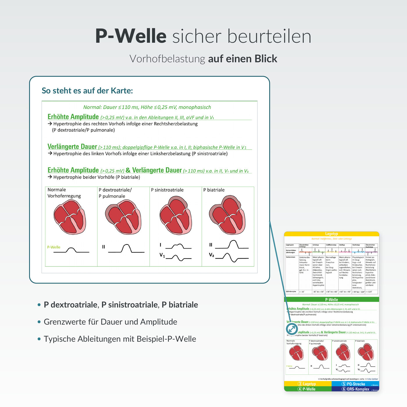 EKG-Spicker: P-Welle sicher beurteilen