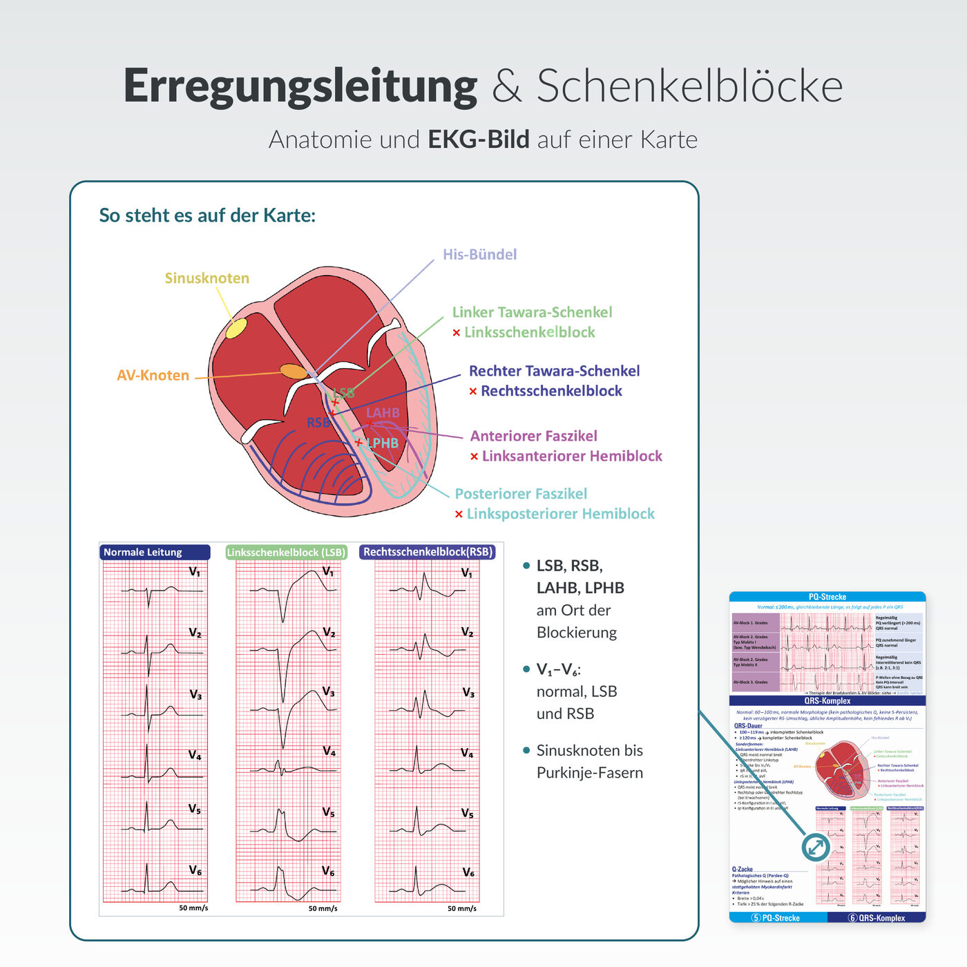 EKG-Spicker: Erregungsleitung und Schenkelblöcke