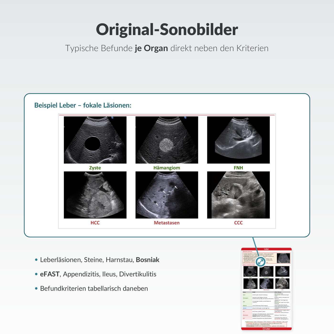 Sono-Spicker: Original-Sonobilder je Organ