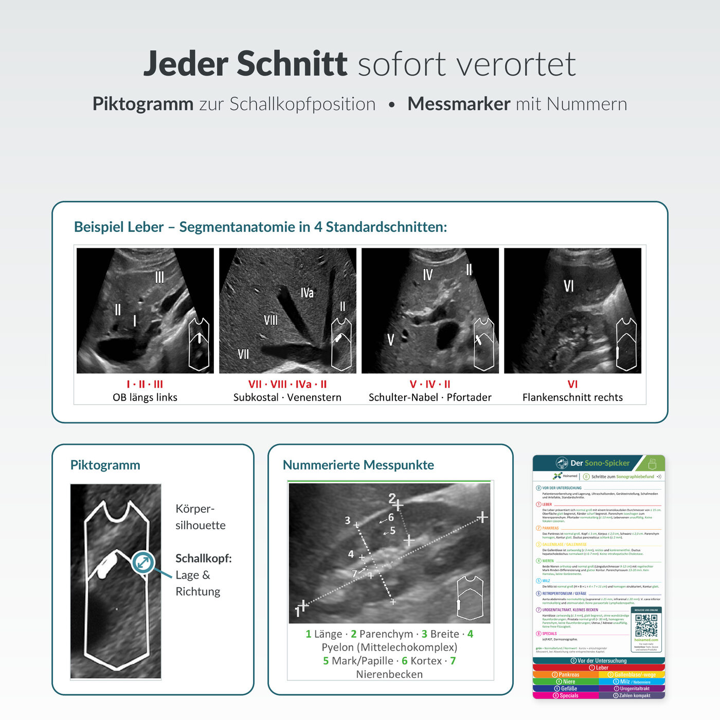 Sono-Spicker: Jeder Schnitt sofort verortet